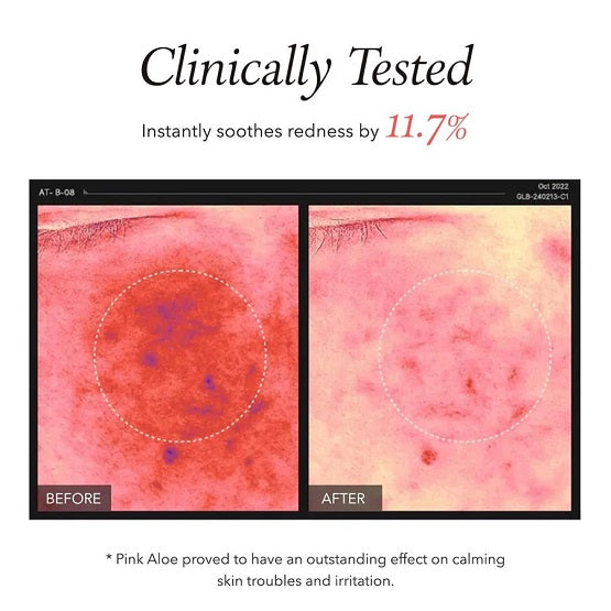 APRILSKIN Pink Aloe Pack Cleanser 120g Price In Pakistan 