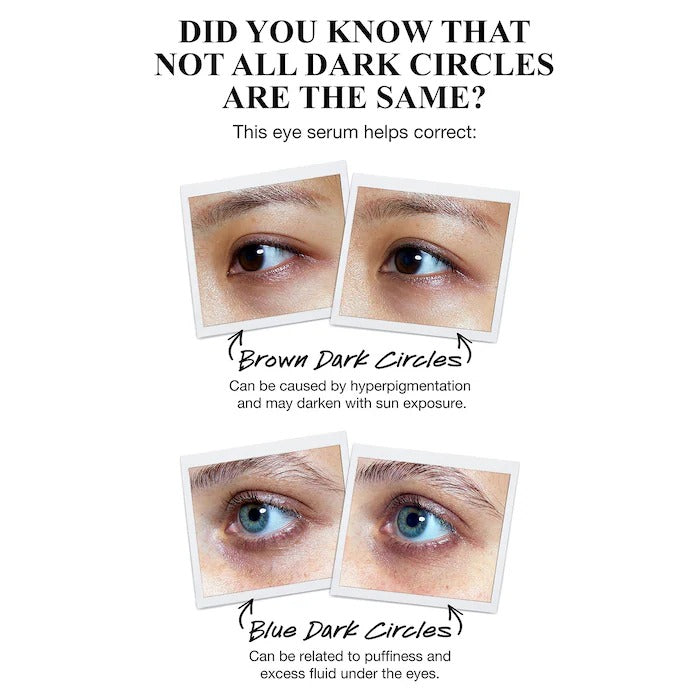 KIEHLS Powerful-Strength Dark Circle Reducing Vitamin C Eye Serum 15ML In Pakistan