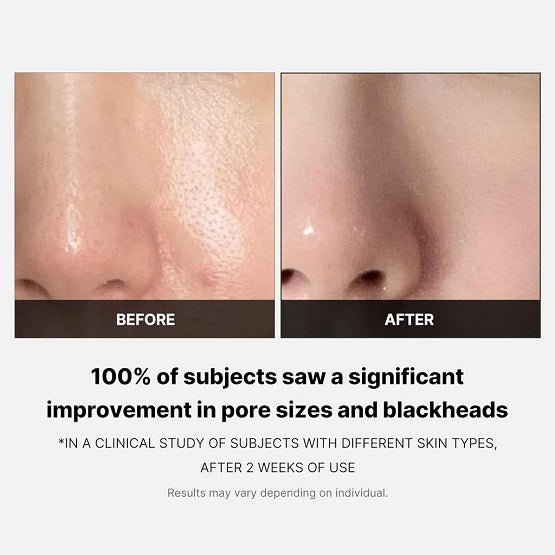 Medicube – Zero Pore Pad 2.0 (70 Pads) - 155g