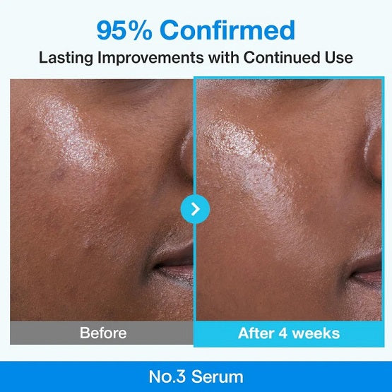 Numbuzin No.3 Blue Bio-Retinol Pore Refining Serum 30ml In Pakistan