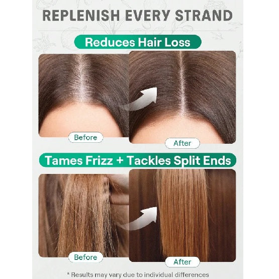 SHEGLAM HAIR Red Onion Hair And Scalp Oil Clear 15ml In Pakistan 