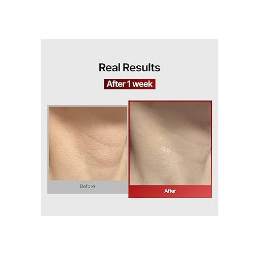 Meditherapy - Wrinkle-Fit Neck Mask - 10g